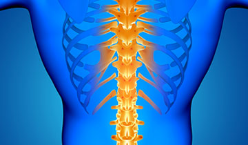 Compression Fracture Treatment