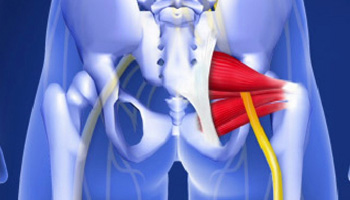 Fluoroscopic Guided Piriformis