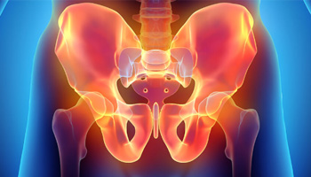 Pelvic Pain