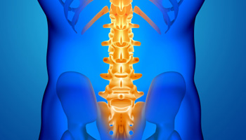 Radiofrequency Neuroablation