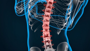 Vertebroplasty and Kyphoplasty